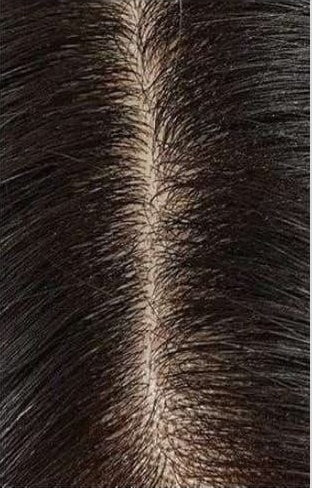 Customer-submitted close-up scalp and hair appearance after continued use