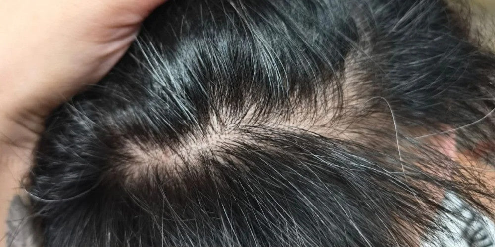 Customer-submitted parted scalp and hair appearance before continued use